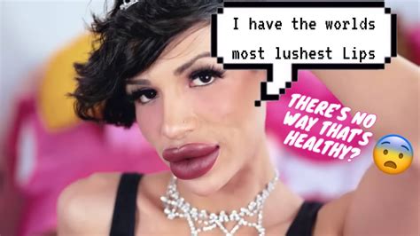 I'll Keep Getting Fillers Until My Lips Explode .